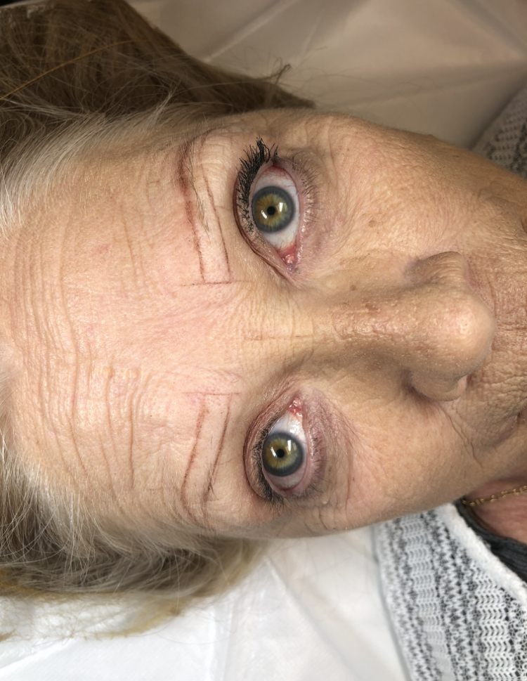 Cancer Patients Deserve Microblading Cincinnati Better Brows