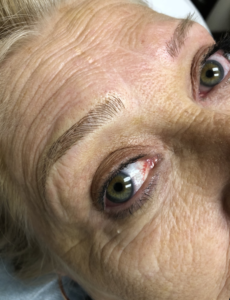 Cancer Patients Deserve Microblading Cincinnati Better Brows