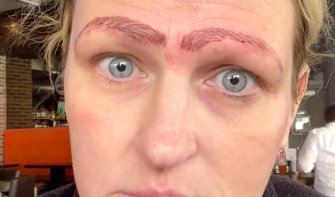 microblading gone wrong